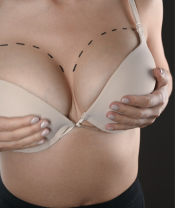 Breast reduction (Reduction Mammaplasty)