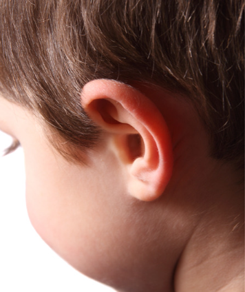 Prominent ear surgery (Otoplasty)
